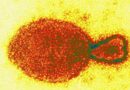 Langya henipavirus: veja o que se sabe até agora sobre o novo vírus da China